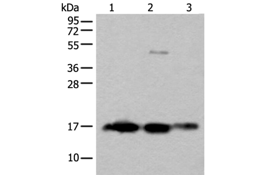 SNCB Antibody from Signalway Antibody (43845) - Antibodies.com
