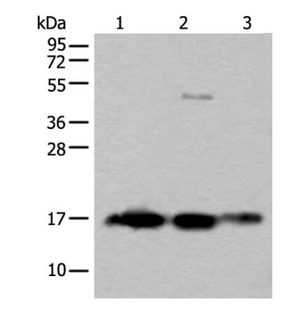 SNCB Antibody from Signalway Antibody (43845) - Antibodies.com