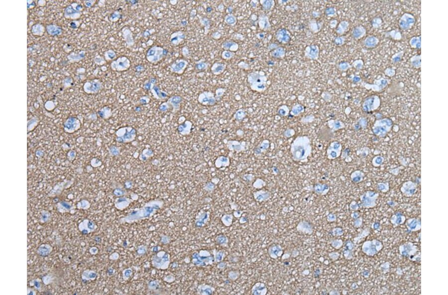 SNCB Antibody from Signalway Antibody (43845) - Antibodies.com