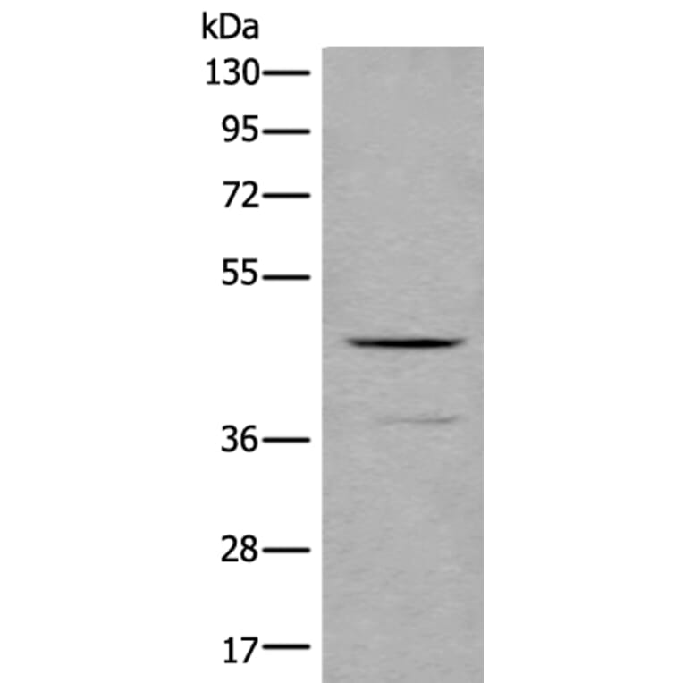 BMP2 Antibody from Signalway Antibody (43851) - Antibodies.com