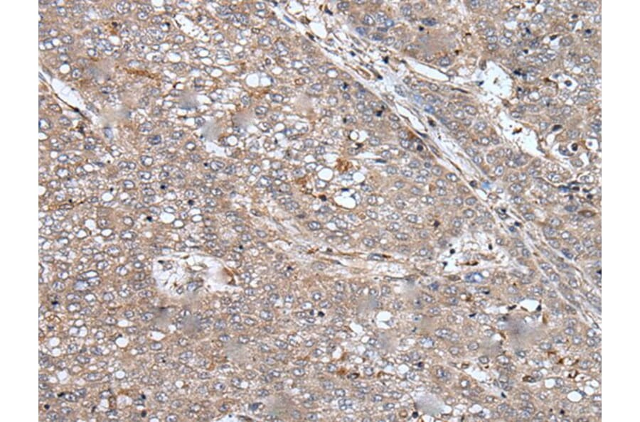 BMP2 Antibody from Signalway Antibody (43851) - Antibodies.com