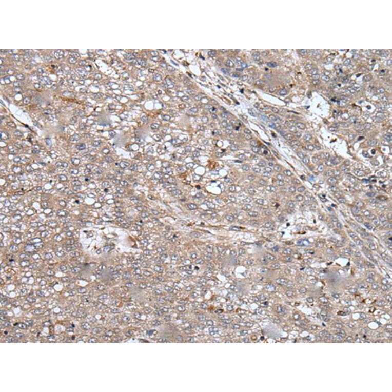 BMP2 Antibody from Signalway Antibody (43851) - Antibodies.com