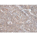 BMP2 Antibody from Signalway Antibody (43851) - Antibodies.com