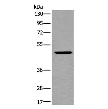BMP4 Antibody from Signalway Antibody (43852) - Antibodies.com