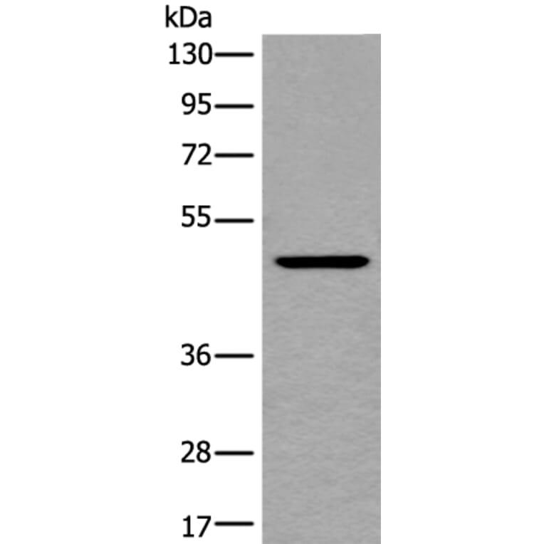 BMP4 Antibody from Signalway Antibody (43852) - Antibodies.com