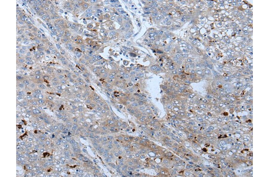 BMP4 Antibody from Signalway Antibody (43852) - Antibodies.com