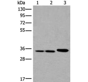 RPF2 Antibody from Signalway Antibody (43856) - Antibodies.com
