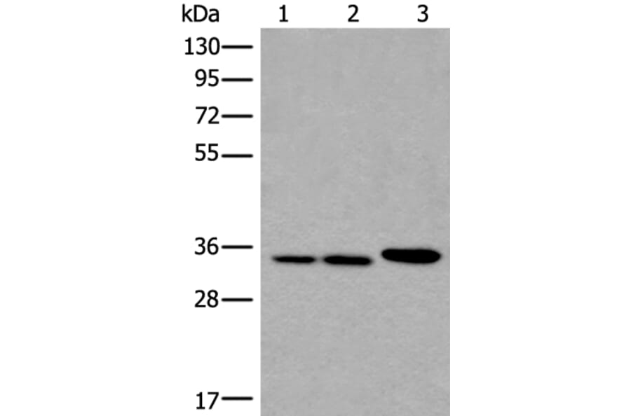 RPF2 Antibody from Signalway Antibody (43856) - Antibodies.com