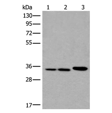 RPF2 Antibody from Signalway Antibody (43856) - Antibodies.com