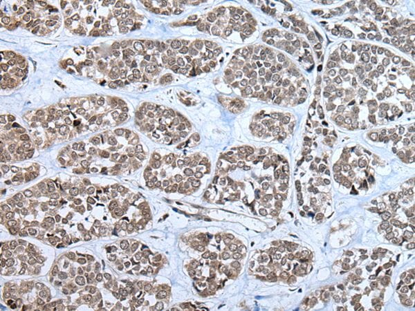 Anti-RPF2 Antibody (A44528) | Antibodies.com