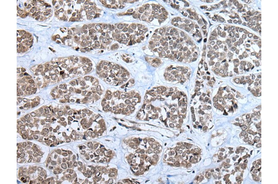 RPF2 Antibody from Signalway Antibody (43856) - Antibodies.com