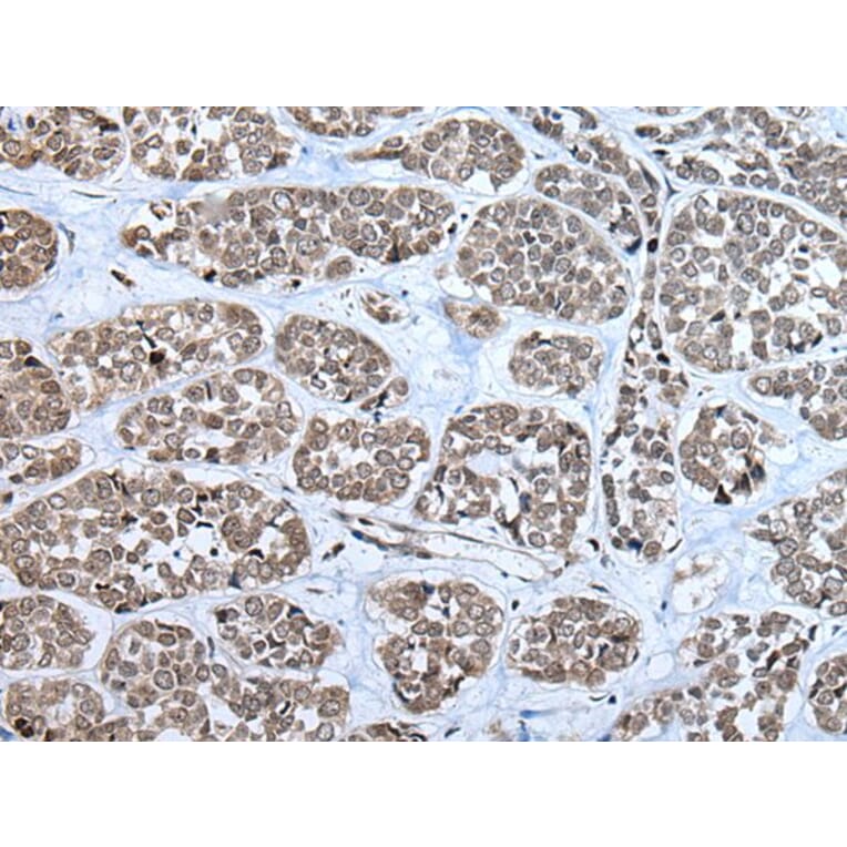 RPF2 Antibody from Signalway Antibody (43856) - Antibodies.com