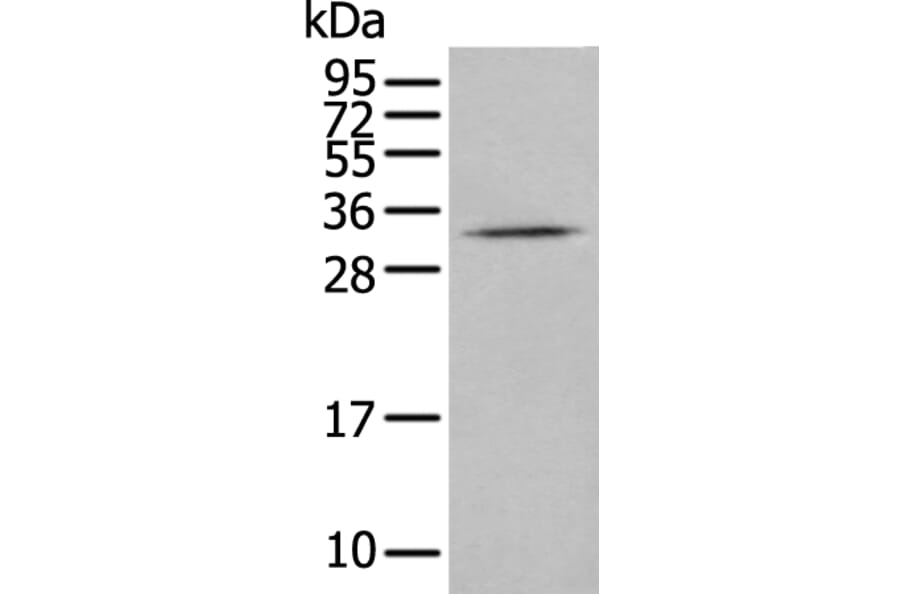 CISH Antibody from Signalway Antibody (43887) - Antibodies.com