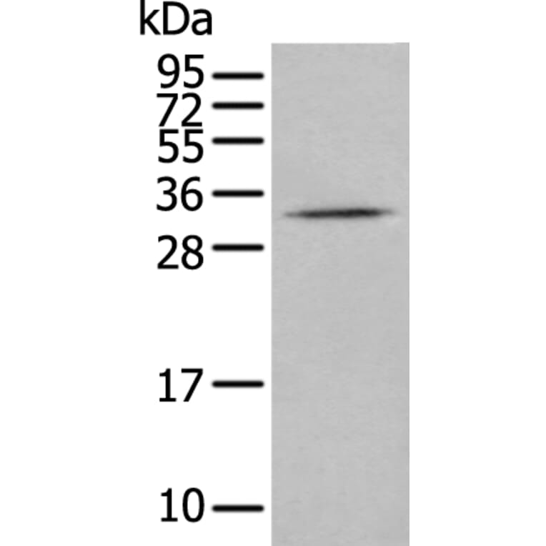 CISH Antibody from Signalway Antibody (43887) - Antibodies.com