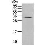 CISH Antibody from Signalway Antibody (43887) - Antibodies.com