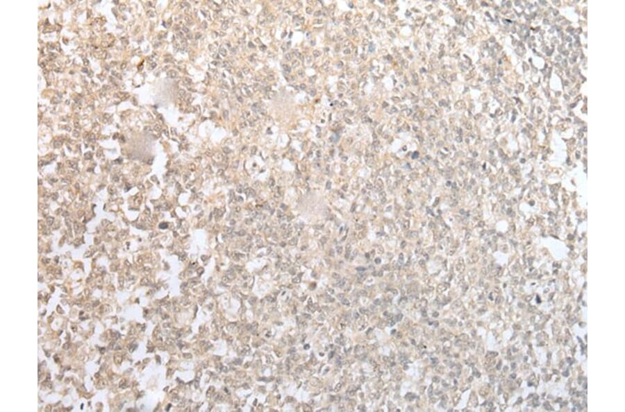 CISH Antibody from Signalway Antibody (43887) - Antibodies.com