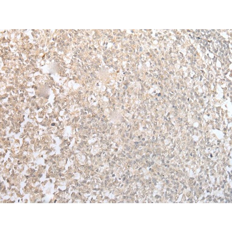 CISH Antibody from Signalway Antibody (43887) - Antibodies.com