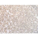 CISH Antibody from Signalway Antibody (43887) - Antibodies.com