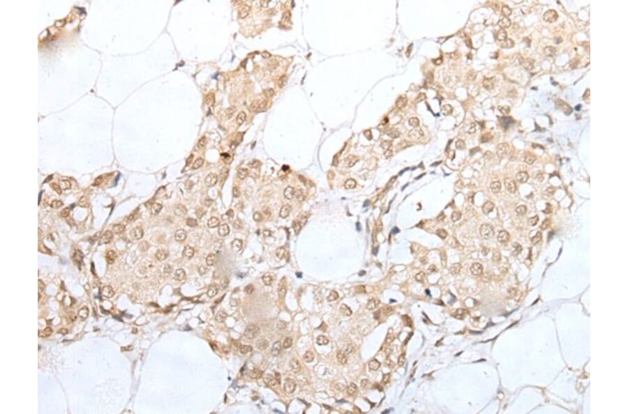 CISH Antibody from Signalway Antibody (43887) - Antibodies.com