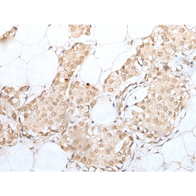 CISH Antibody from Signalway Antibody (43887) - Antibodies.com