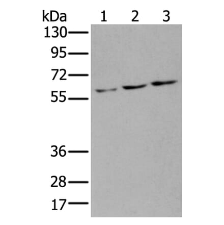 ZNF8 Antibody from Signalway Antibody (43891) - Antibodies.com