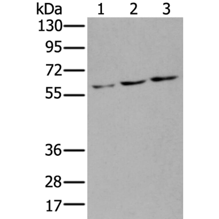 ZNF8 Antibody from Signalway Antibody (43891) - Antibodies.com