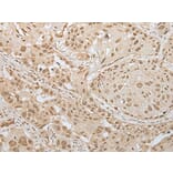 ZNF8 Antibody from Signalway Antibody (43891) - Antibodies.com