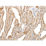 ZNF8 Antibody from Signalway Antibody (43891) - Antibodies.com