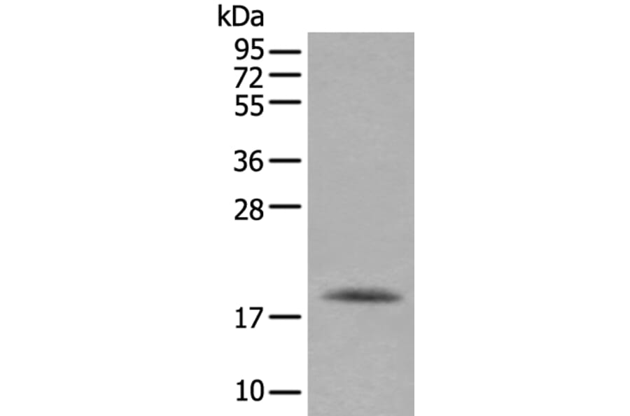 RAC2 Antibody from Signalway Antibody (43907) - Antibodies.com