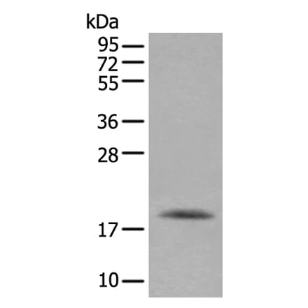 RAC2 Antibody from Signalway Antibody (43907) - Antibodies.com