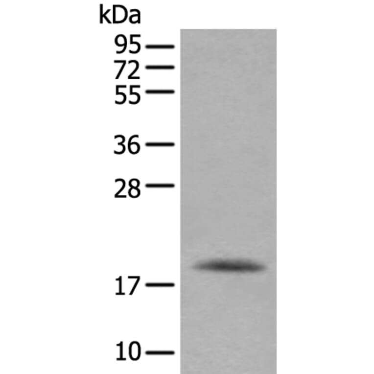 RAC2 Antibody from Signalway Antibody (43907) - Antibodies.com