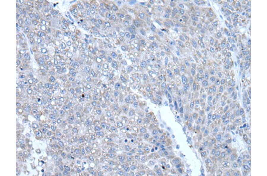 RAC2 Antibody from Signalway Antibody (43907) - Antibodies.com