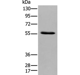 GPC4 Antibody from Signalway Antibody (43924) - Antibodies.com