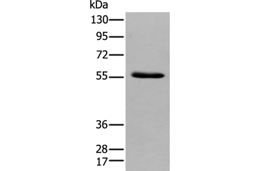 GPC4 Antibody from Signalway Antibody (43924) - Antibodies.com