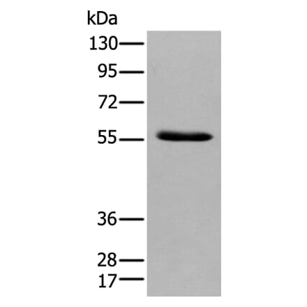GPC4 Antibody from Signalway Antibody (43924) - Antibodies.com