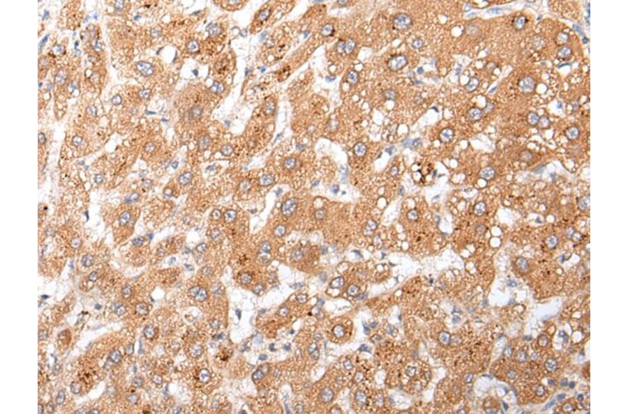 GLI3 Antibody from Signalway Antibody (43925) - Antibodies.com