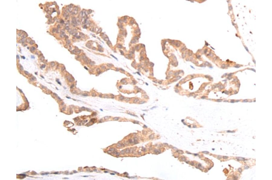 GLI3 Antibody from Signalway Antibody (43925) - Antibodies.com