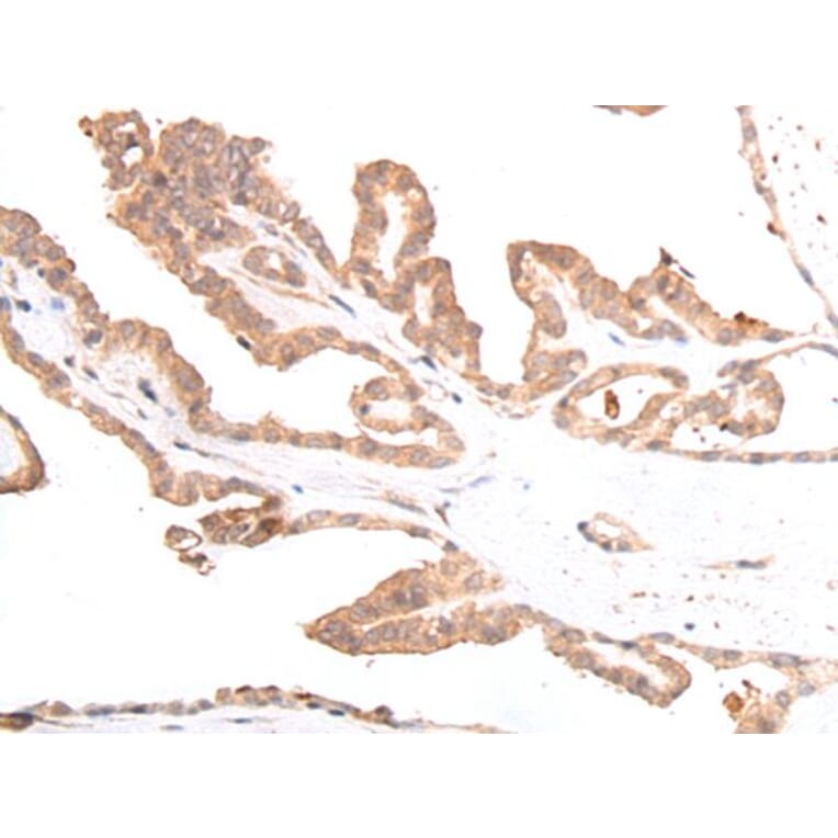 GLI3 Antibody from Signalway Antibody (43925) - Antibodies.com