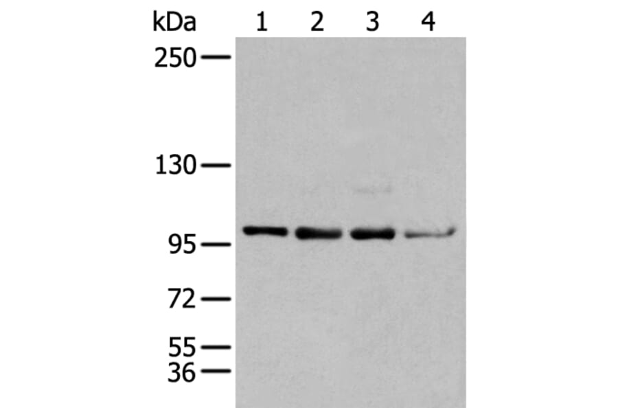 GLI1 Antibody from Signalway Antibody (43926) - Antibodies.com