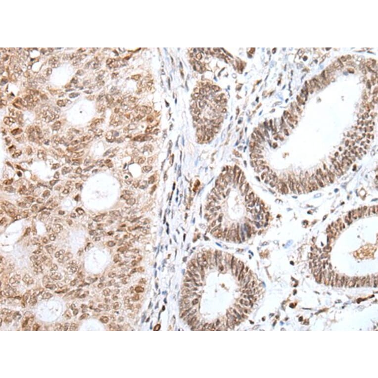 GLI1 Antibody from Signalway Antibody (43926) - Antibodies.com