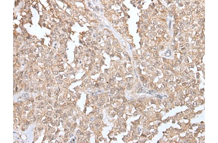 GLI1 Antibody from Signalway Antibody (43926) - Antibodies.com