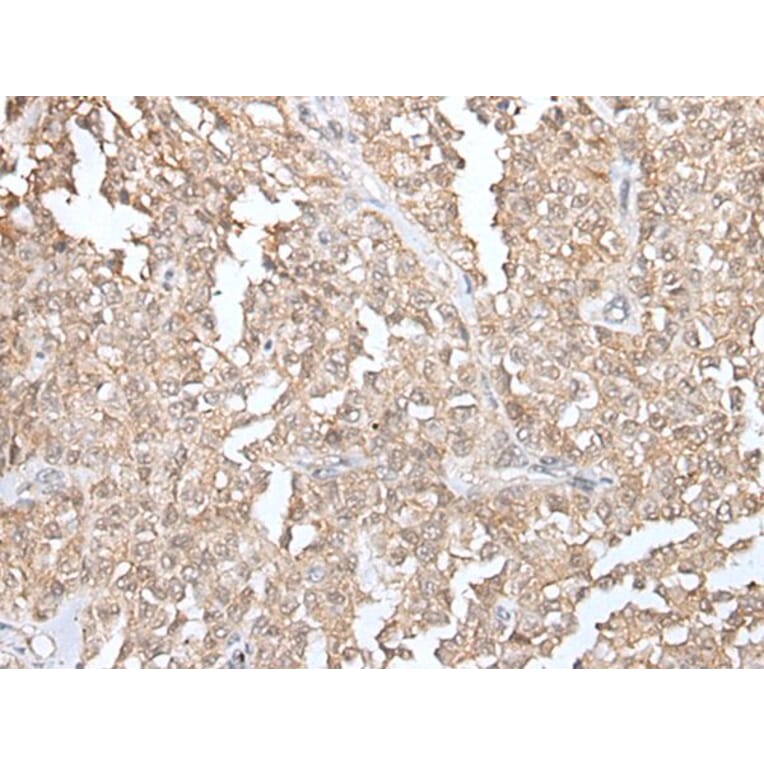 GLI1 Antibody from Signalway Antibody (43926) - Antibodies.com