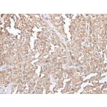GLI1 Antibody from Signalway Antibody (43926) - Antibodies.com