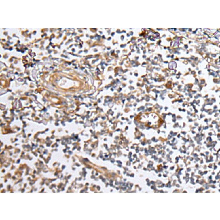 CUBN Antibody from Signalway Antibody (43937) - Antibodies.com