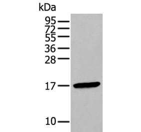 FSHB Antibody from Signalway Antibody (43940) - Antibodies.com
