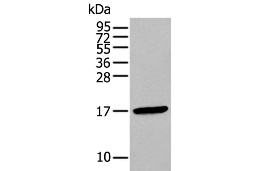 FSHB Antibody from Signalway Antibody (43940) - Antibodies.com
