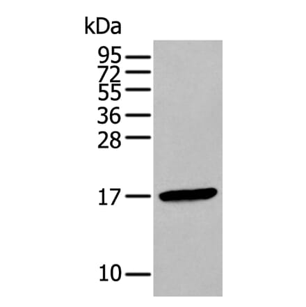 FSHB Antibody from Signalway Antibody (43940) - Antibodies.com