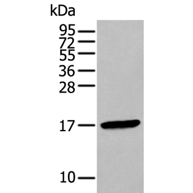 FSHB Antibody from Signalway Antibody (43940) - Antibodies.com