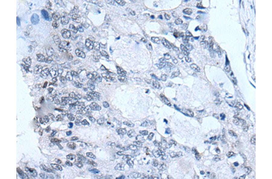 FSHB Antibody from Signalway Antibody (43940) - Antibodies.com
