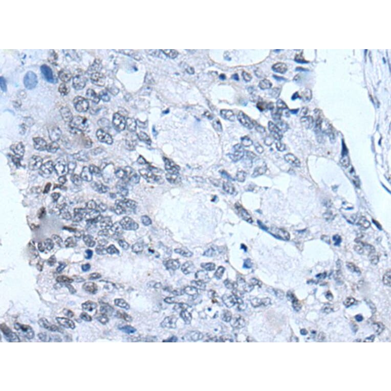 FSHB Antibody from Signalway Antibody (43940) - Antibodies.com